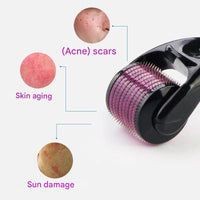 Anti-Aging Mikronadel-Roller – Luméra