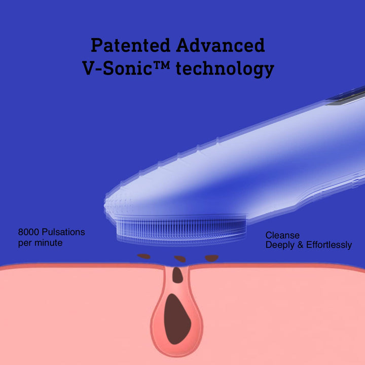Elektrische Gesichtsreinigungsbürste, blau, V-Sonic-Technologie, 8000 Pulsationen pro Minute.