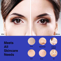 Vorher-Nachher-Bild Gesichtspflege, Porenreinigung, Hautunreinheiten, Make-up-Rückstände.