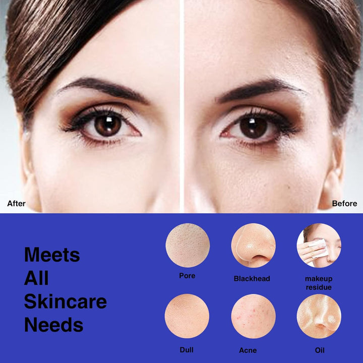 Vorher-Nachher-Bild Gesichtspflege, Porenreinigung, Hautunreinheiten, Make-up-Rückstände.