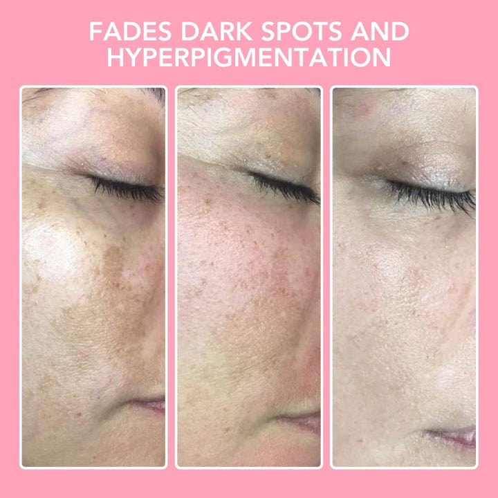 Kurkuma Kojinsäure Reinigungspads - GlowTonic