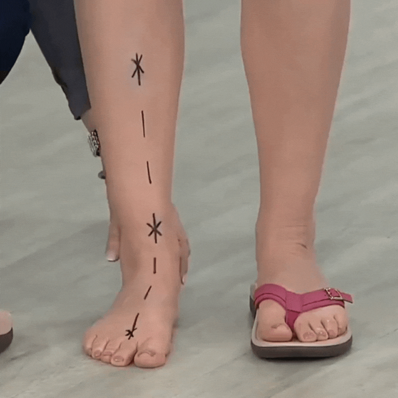 Orthopädische Damenzehensandalen – Mira