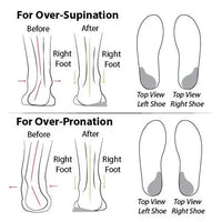 Bequeme Orthopädische Herbstschuhe mit Dämpfung – Tessa