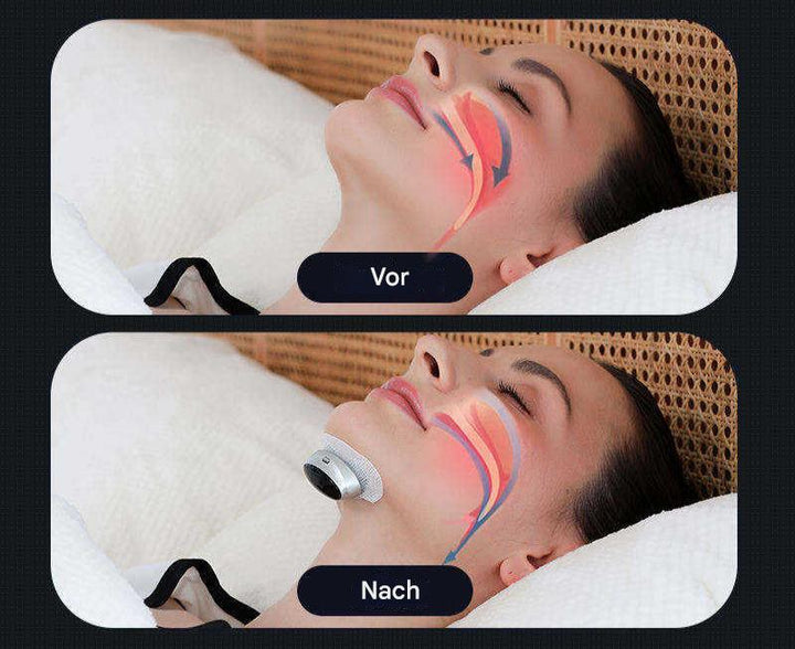 Frau bei Gesichtsbehandlung mit Hautstraffungsgerät, Vorher-Nachher-Vergleich, Anti-Aging.