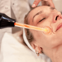 Frau bei Gesichtsbehandlung mit Hochfrequenzstab, Hautpflege, Anti-Aging, Wellness-Salon.
